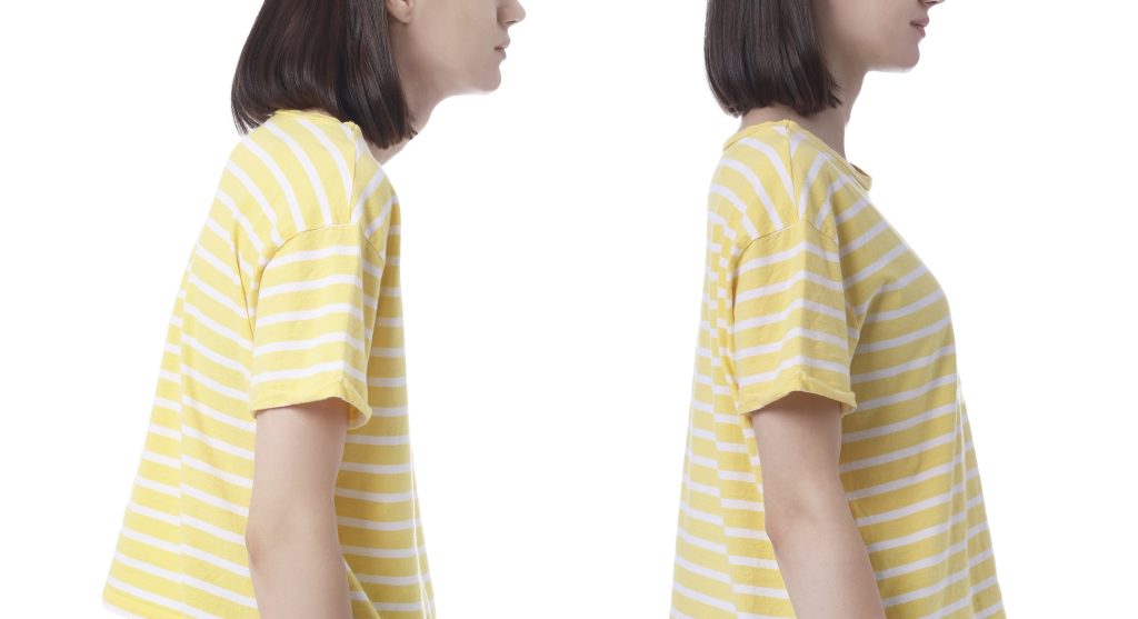 woman-with-poor-and-good-posture
