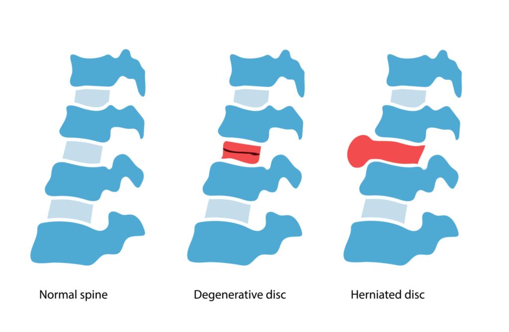 NeckCervical