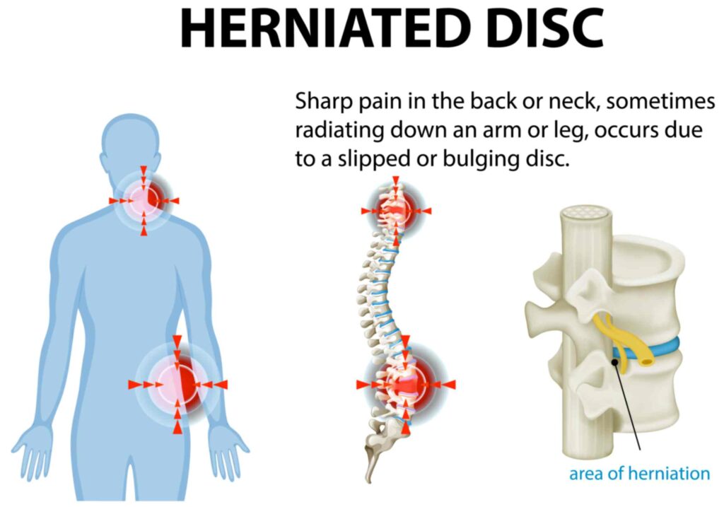 Neck_Cervical