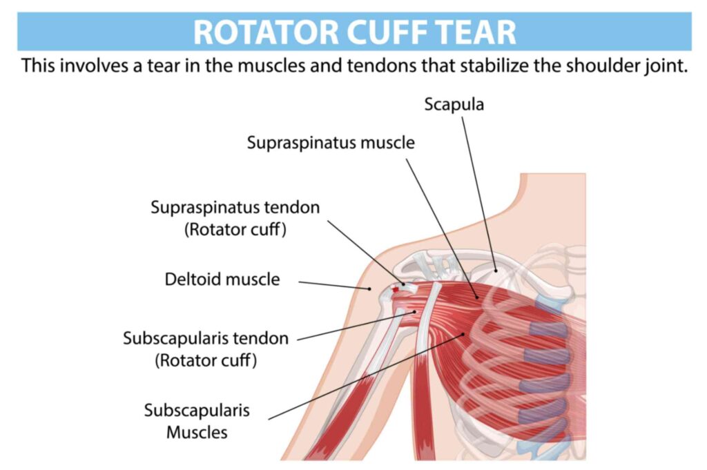 Rotator